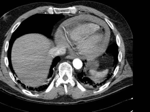 Bildgebung - CT