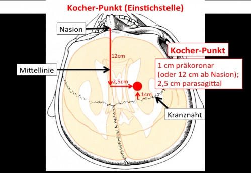 Operationstechnik - EVD-Anlage 
