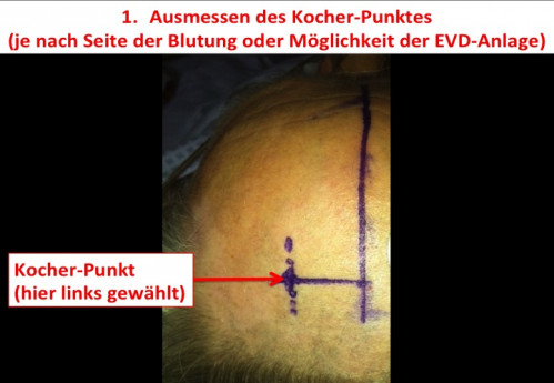 Operationstechnik - EVD-Anlage 