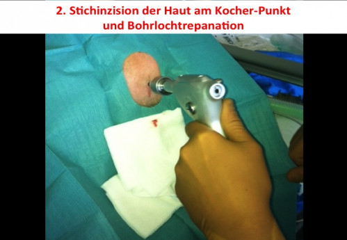 Operationstechnik - EVD-Anlage 