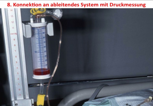 Operationstechnik - EVD-Anlage 