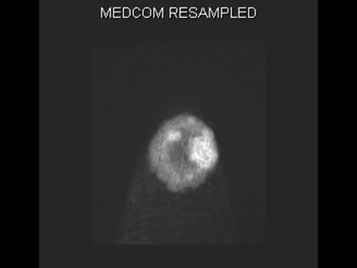 Bildgebung - MRT axial präoperativ