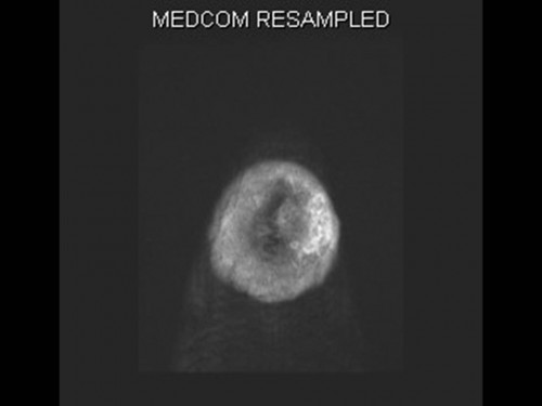 Bildgebung - MRT axial präoperativ