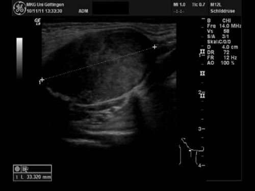 Bildgebung - Sonographie präoperativ