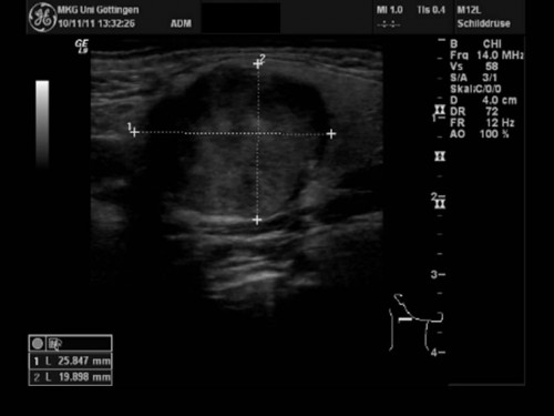 Bildgebung - Sonographie präoperativ