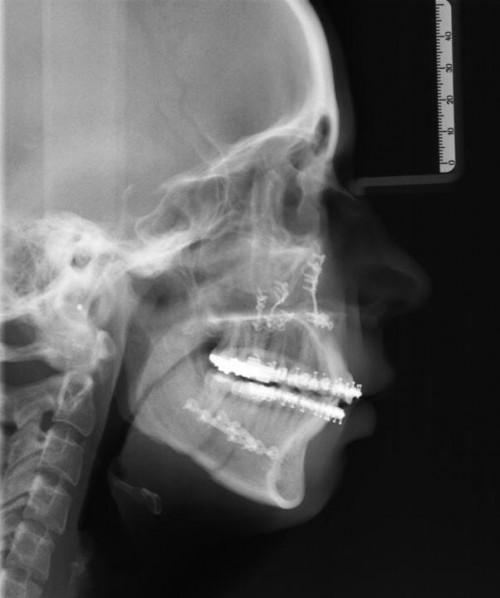 Bildgebung - FRS postoperativ