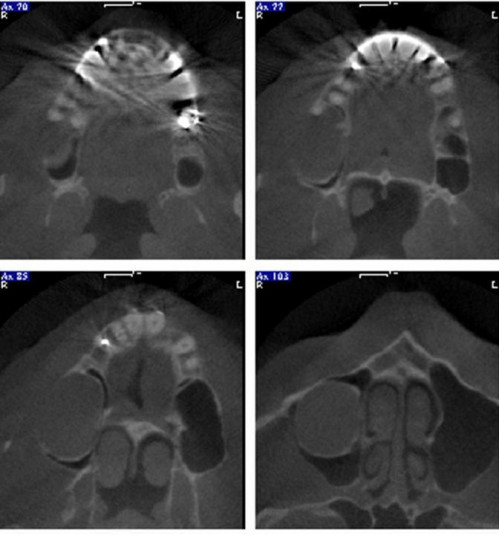 Bildgebung - DVT axial präoperativ