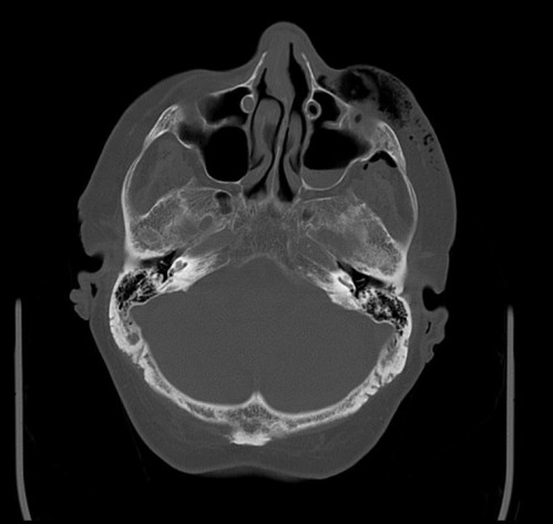 Bildgebung - CT axial präoperativ
