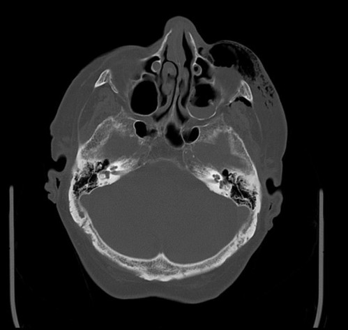 Bildgebung - CT axial präoperativ