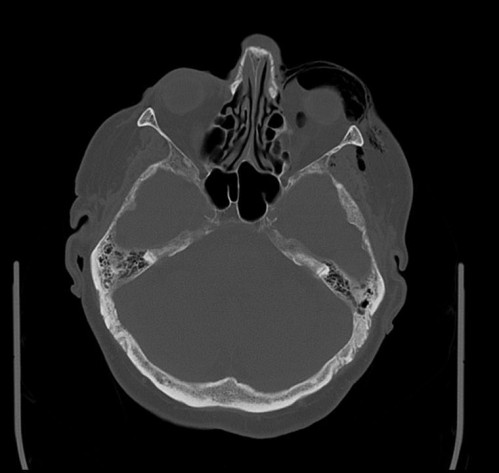 Bildgebung - CT axial präoperativ