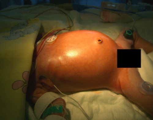 Makroskopie - Inspektionsbefund präoperativ