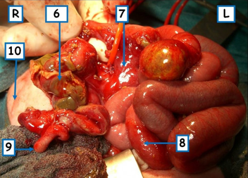 Makroskopie - Situs intraoperativ