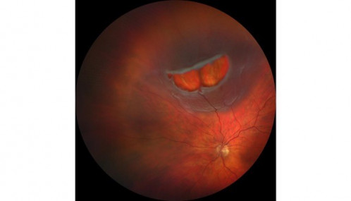 Schatten trotz Sonne