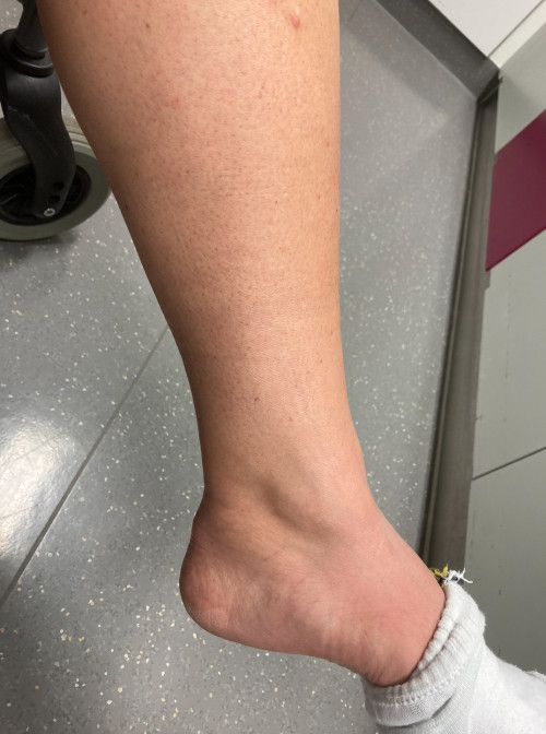 Inspektion Bein links 1