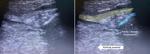 Sonografie Knie 1
