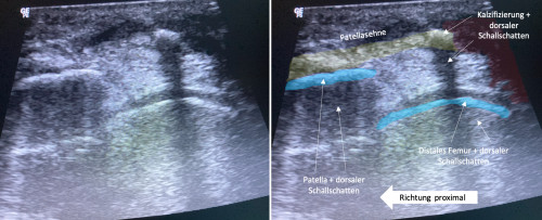 Sonografie 2 beschriftet