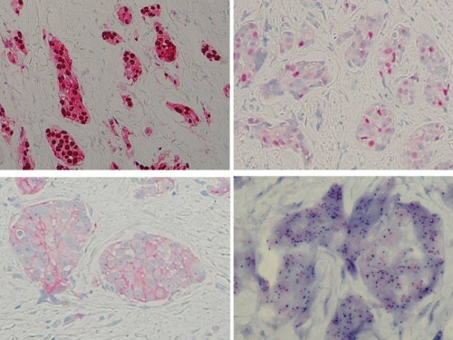 Mikroskopie - Histologie (Immunhistochemie & CISH)