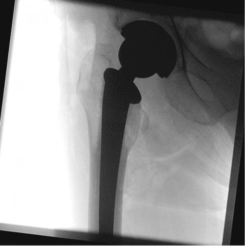 Intraoperative Durchleuchtung