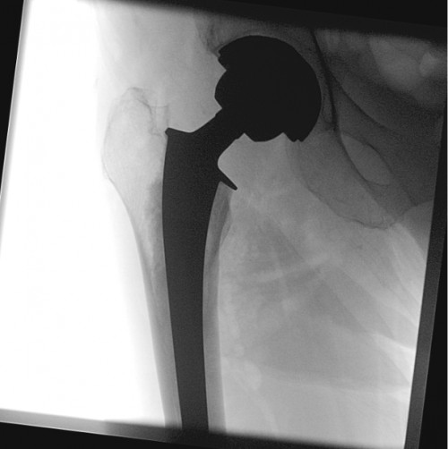 Intraoperative Durchleuchtung