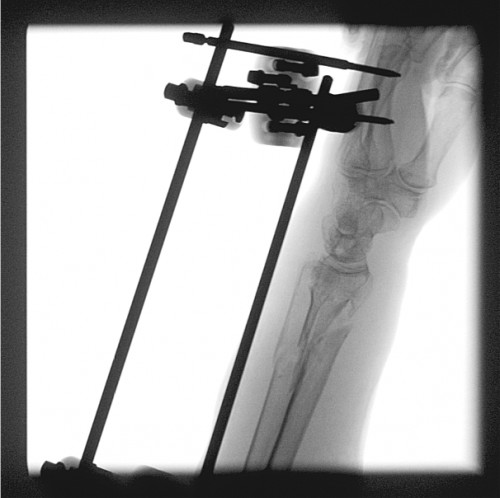 Intraoperative Durchleuchtung