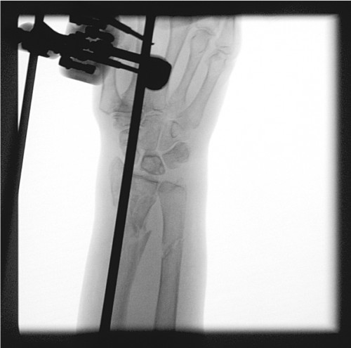 Intraoperative Durchleuchtung