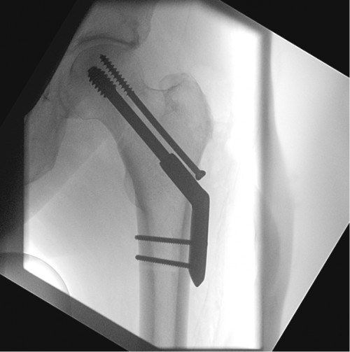 Intraoperative Durchleuchtung