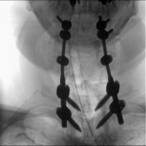 Intraoperative Durchleuchtung