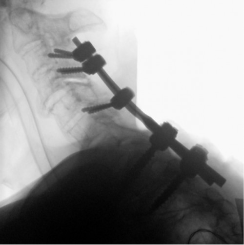 Intraoperative Durchleuchtung