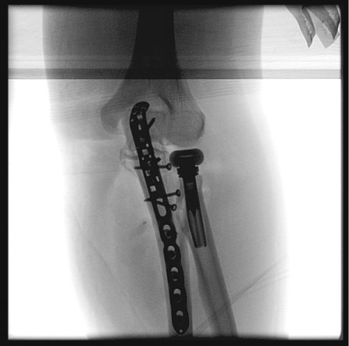 Intraoperative Durchleuchtung