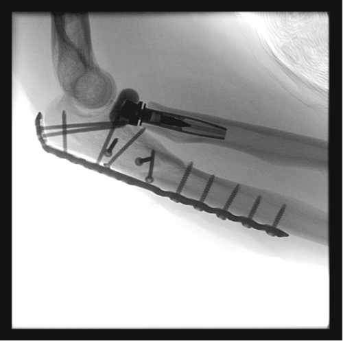 Intraoperative Durchleuchtung