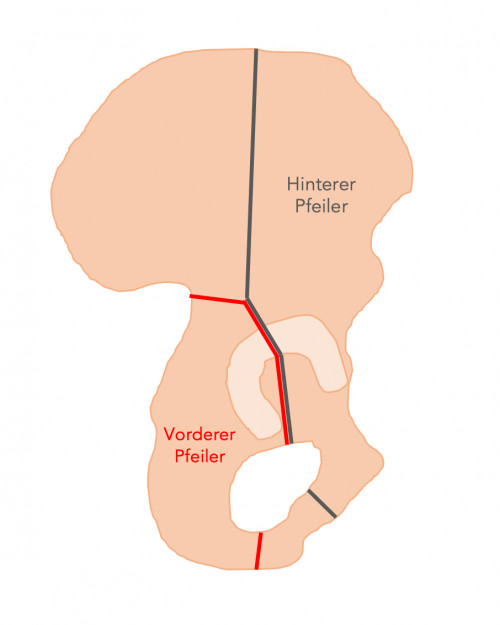 Acetabulum Pfeiler