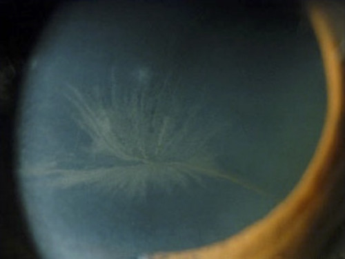 Cornea verticillata