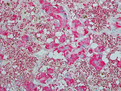 Immunhistochemie - Chromogranin