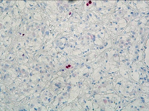 Immunhistochemie - Ki-67