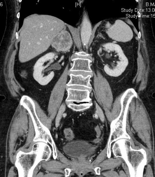 Bildgebung - CT-Abdomen