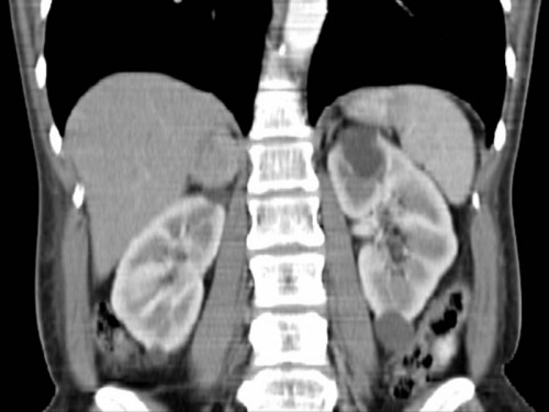 Bildgebung - CT