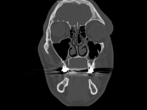 Bildgebung - CT