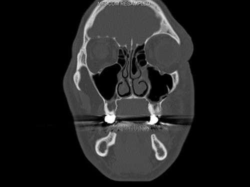 Bildgebung - CT