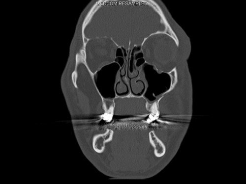 Bildgebung - CT