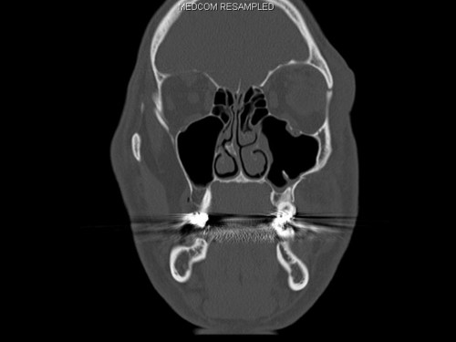 Bildgebung - CT