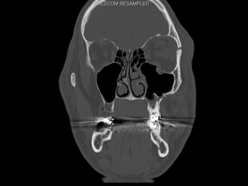 Bildgebung - CT