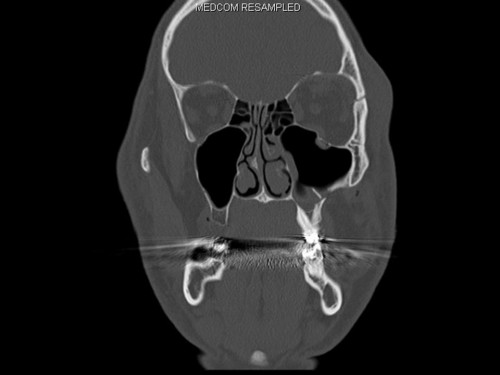 Bildgebung - CT