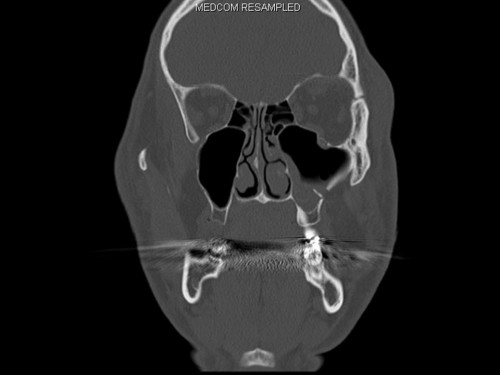 Bildgebung - CT