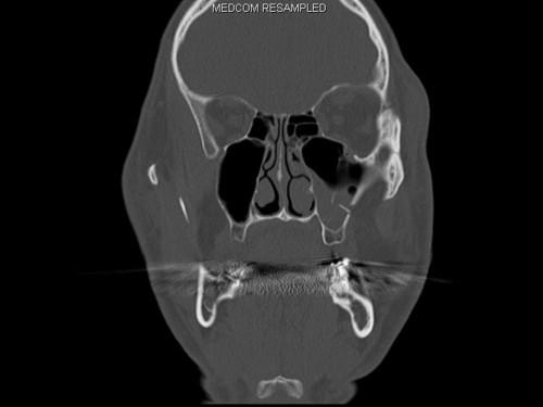 Bildgebung - CT