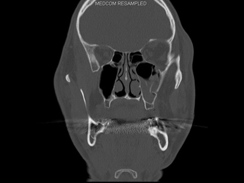 Bildgebung - CT