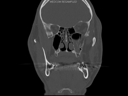 Bildgebung - CT