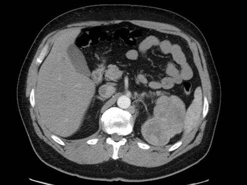 Bildgebung - CT