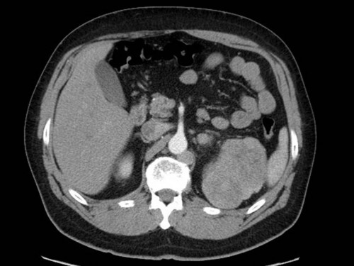 Bildgebung - CT