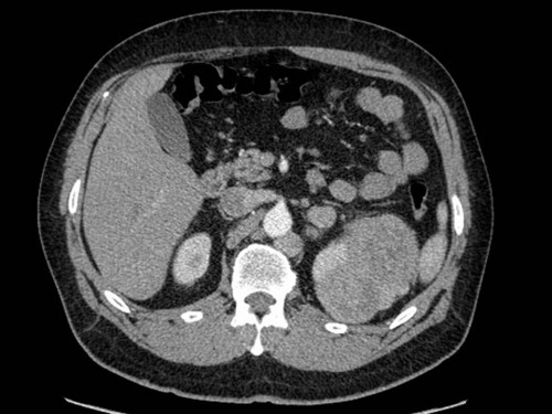 Bildgebung - CT