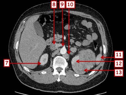Bildgebung - CT